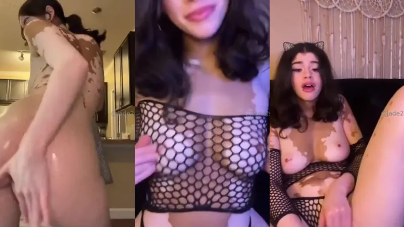 Vitiligo Beauty Strips Down Showcasing Stunning Dual-Tone Skin